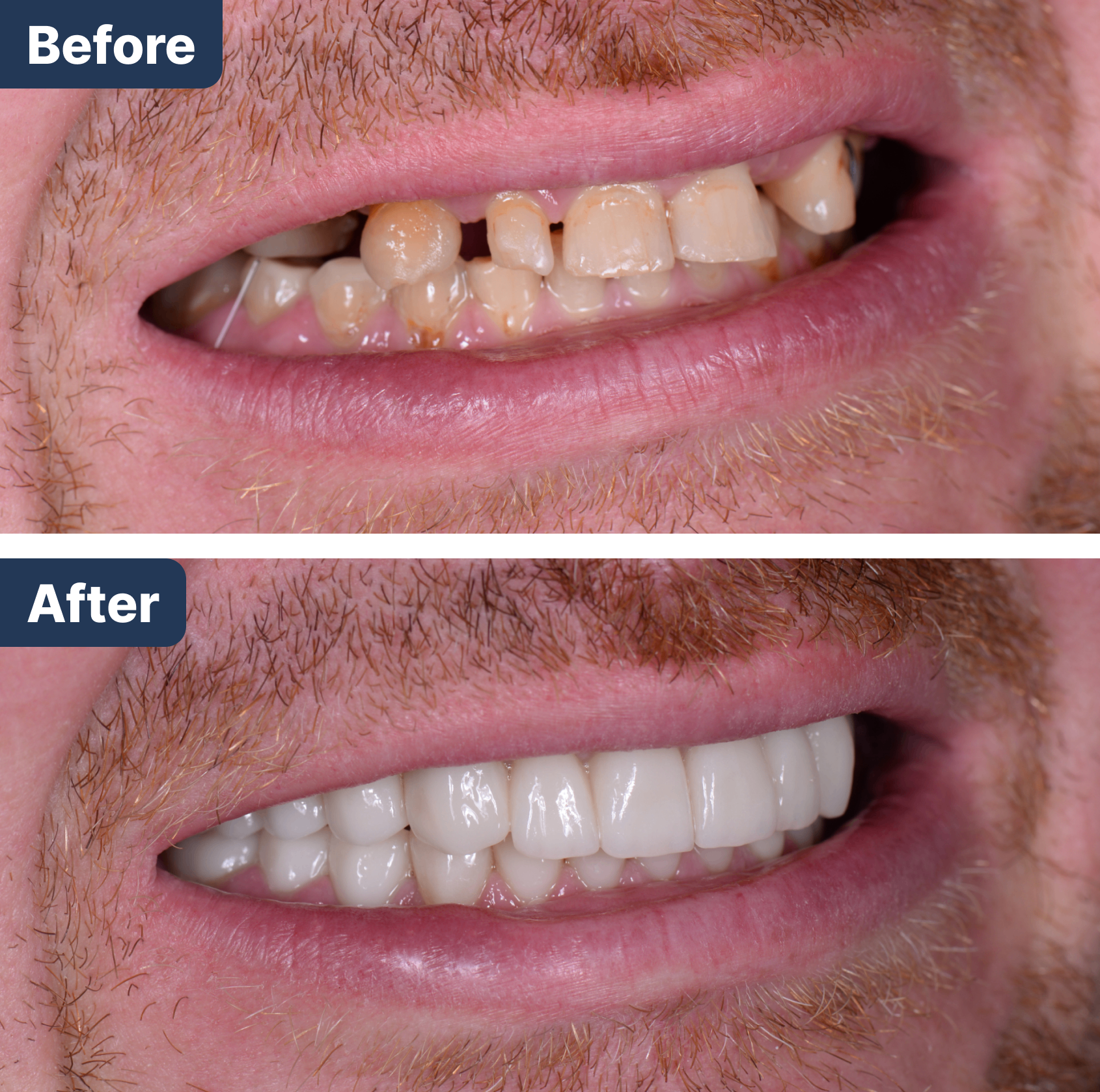 Before and After Treatment