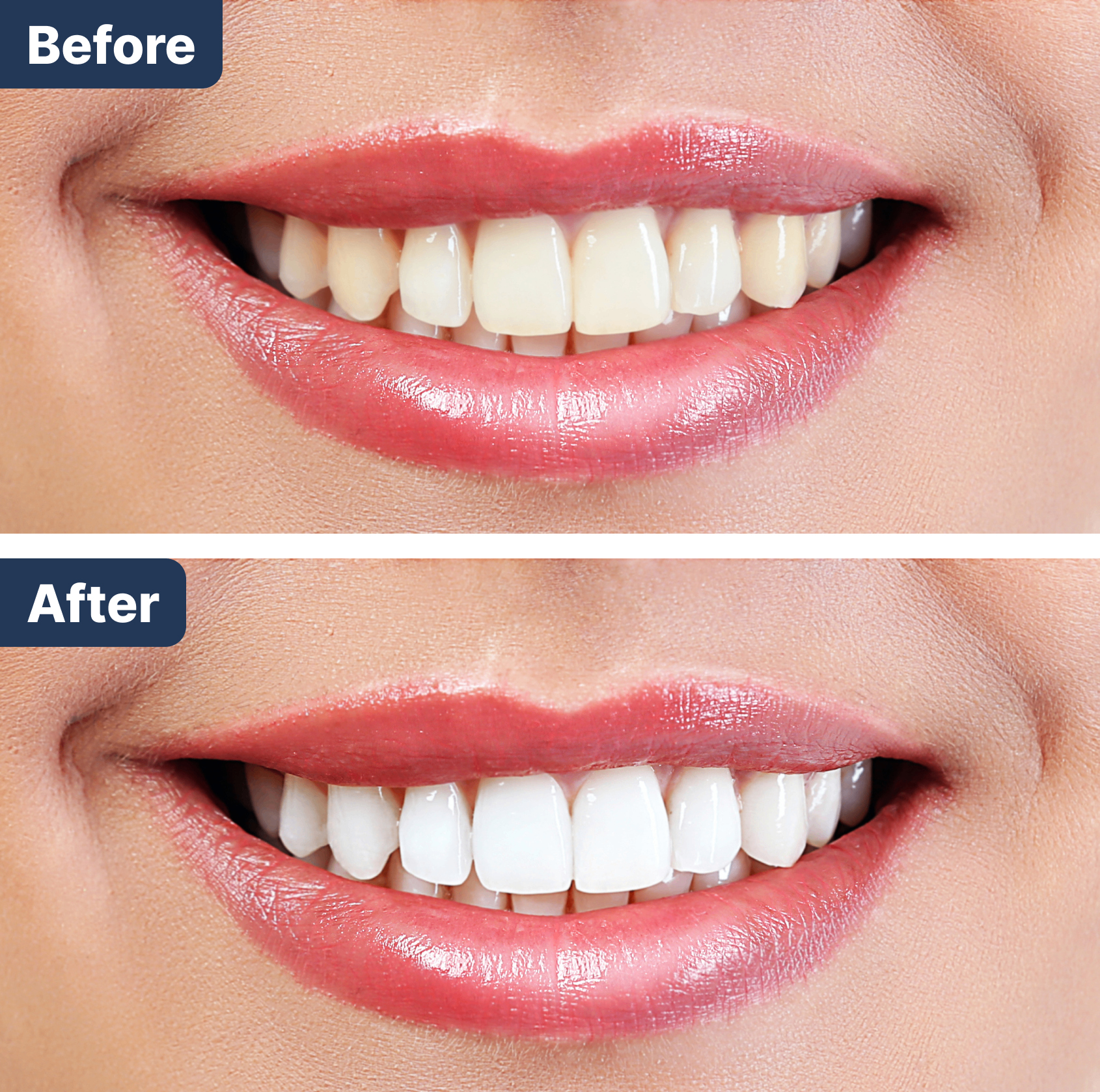 Before and After Treatment